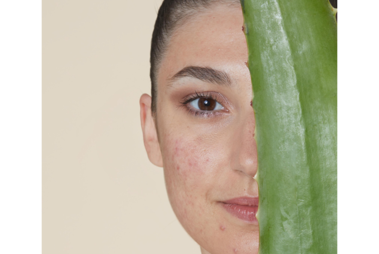 L'acné du cycle - Skin & Out