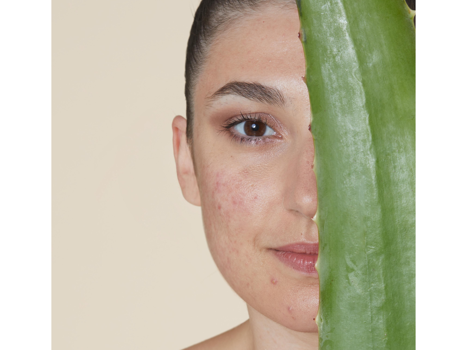 L'acné hormonale traitements naturels - Skin & Out